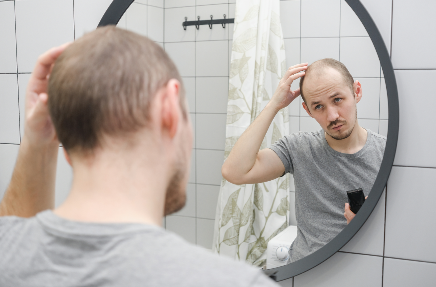 A man with balding hair and hair loss looks into a mirror sadly while touching his scalp. Concept of hair loss tips, thinning hair advice.