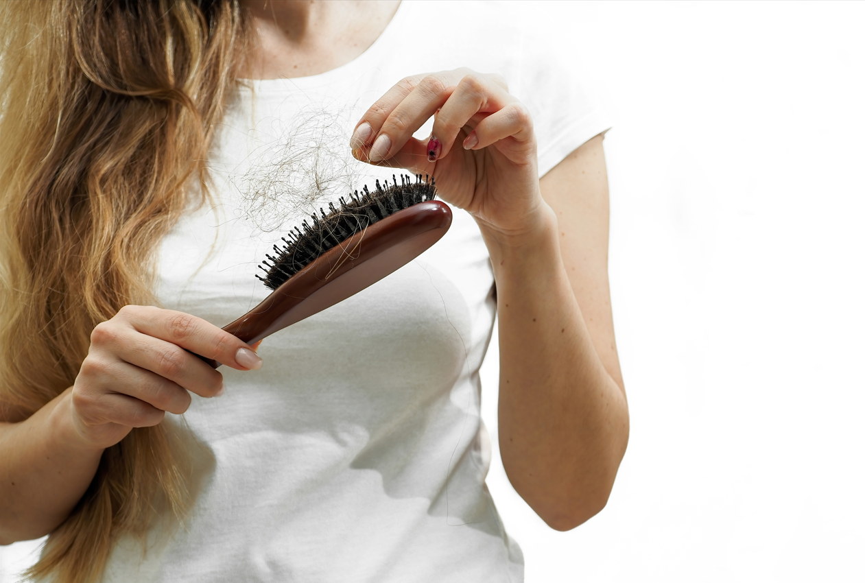 A blonde woman with a hair brush full of fallen hair. Concept of hair loss, hair fall, hair loss remedies, hair loss quick fix.